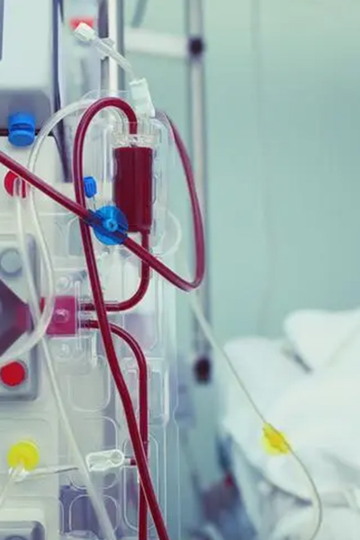 Hemodialysis